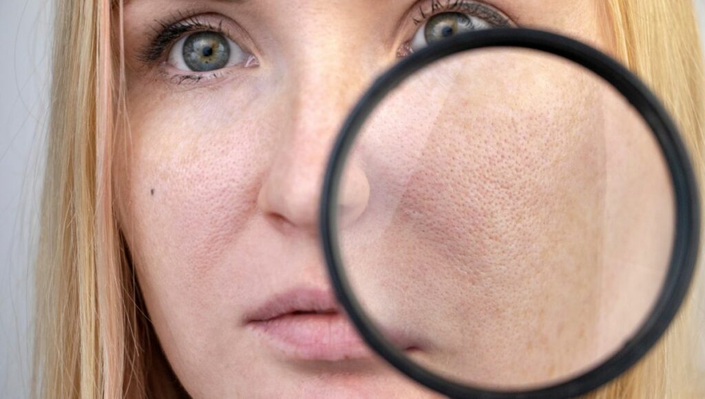 Femme tenant une loupe près de son visage pour examiner de près ses pores dilatés